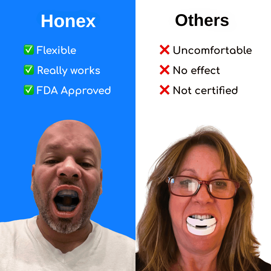 The Quiet Anti-Snoring Mouthpiece Universal Size - BH